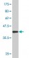 SOX8 Antibody (monoclonal) (M03)